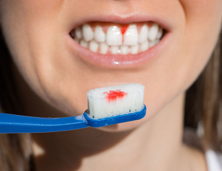 仙台市青葉区台原の歯医者、台原みなも歯科クリニックの歯周病治療