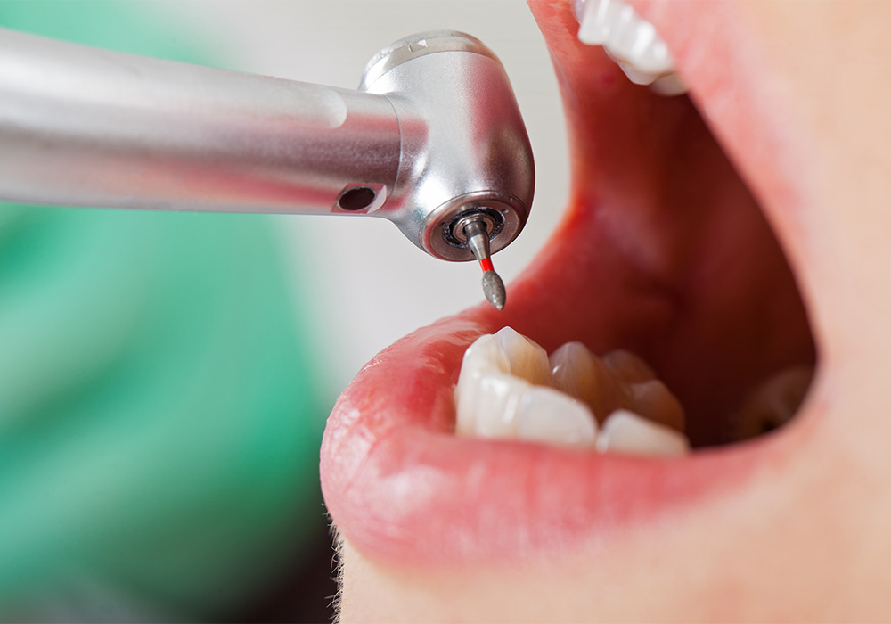 仙台市青葉区台原の歯医者、台原みなも歯科クリニックのカウンセリングを重視した診療