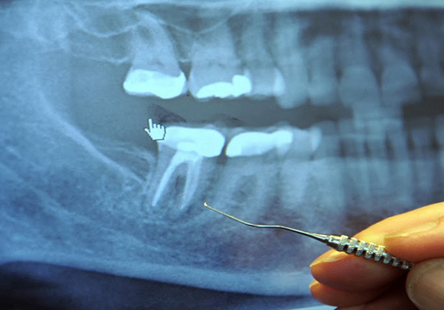 仙台市青葉区台原の歯医者、台原みなも歯科クリニックのカウンセリングを重視した診療