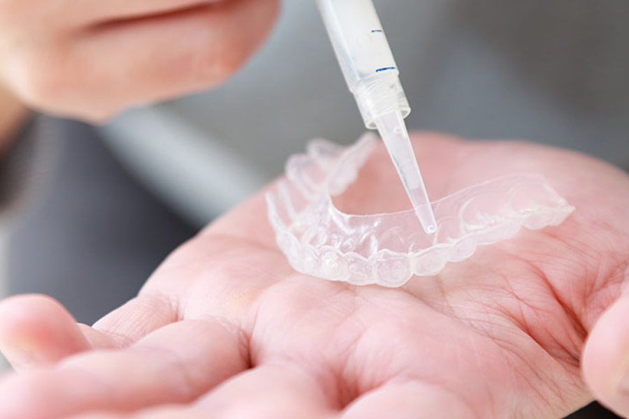 仙台市青葉区台原の歯医者、台原みなも歯科クリニックのホワイトニング