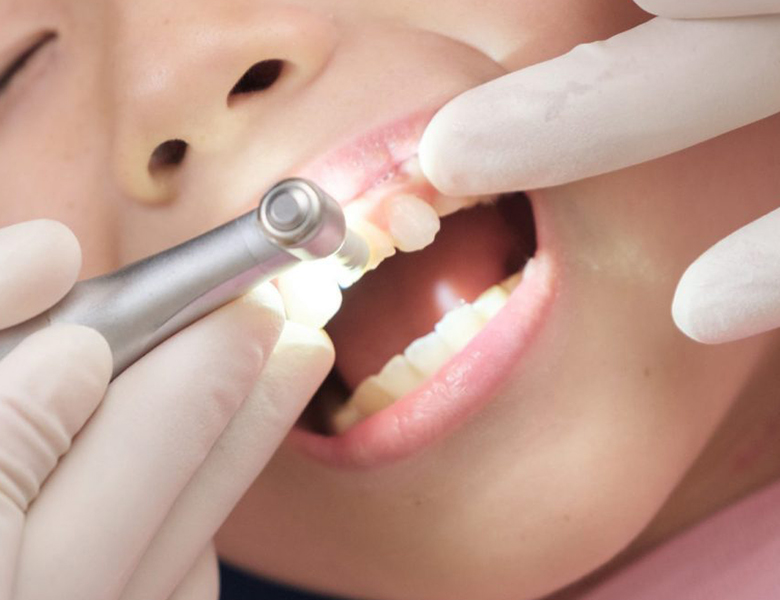 仙台市青葉区台原の歯医者、台原みなも歯科クリニックの小児歯科治療